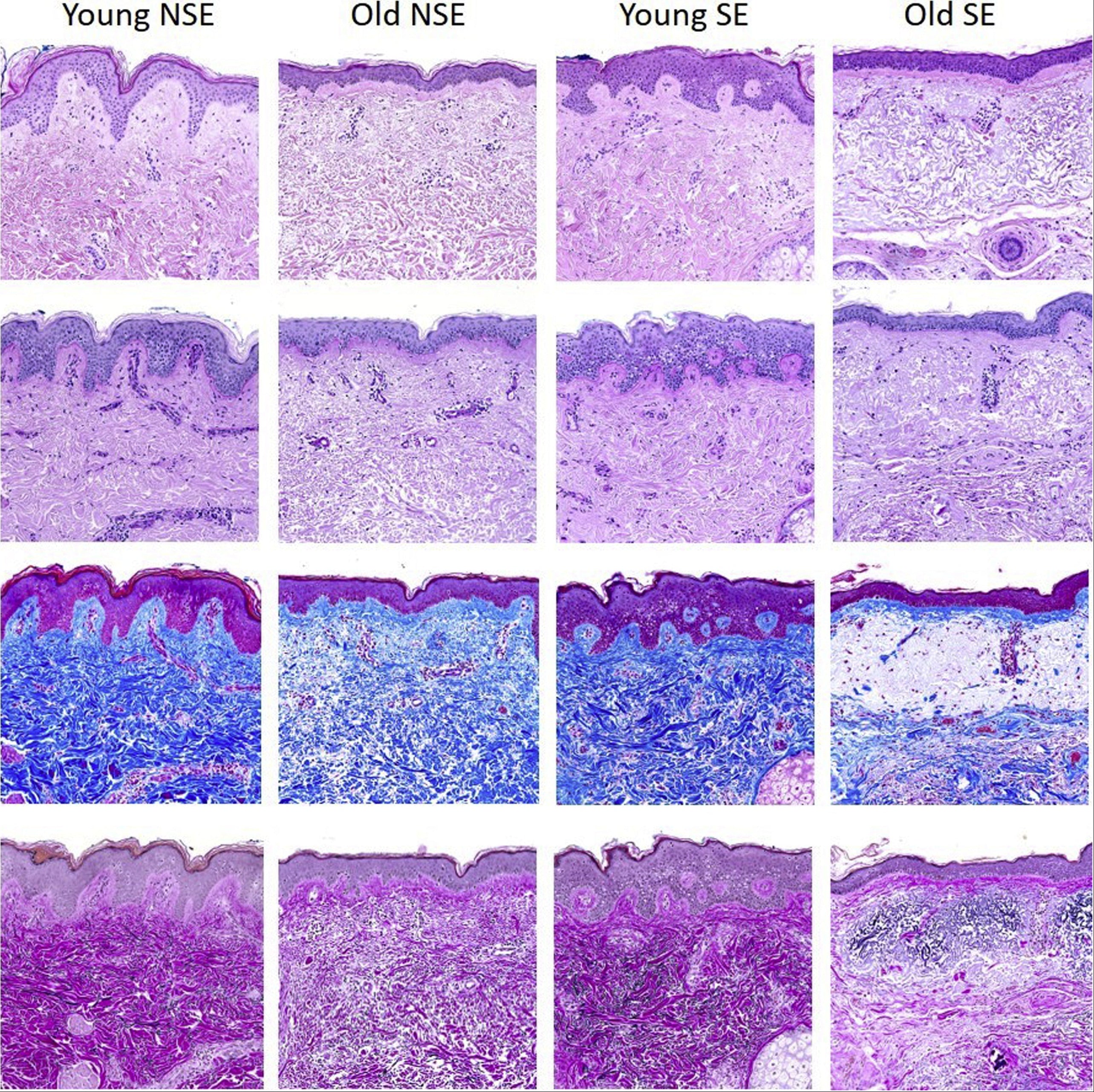 Histological sections f young skin, old skin, why skin ages stem cell exhaustion.